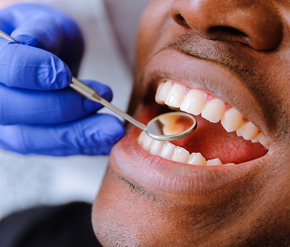 Dentist checking patient's smile after tooth colored filling treatment