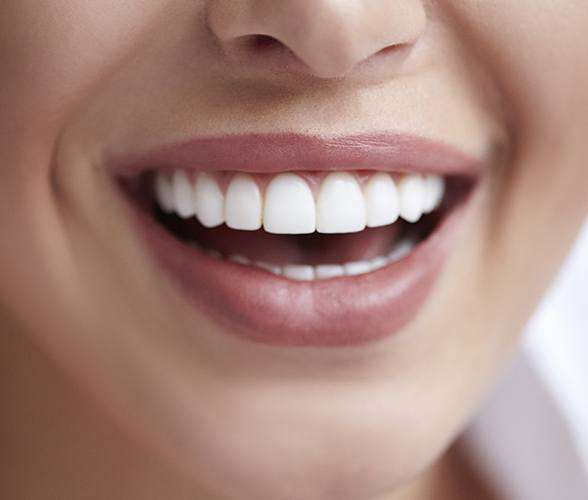 Closeup of healthy smile after fluoride treatment